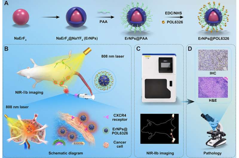 Novel nanoprobe helps realize in vivo real-time detection of sentinel lymph node metastases in breast cancer