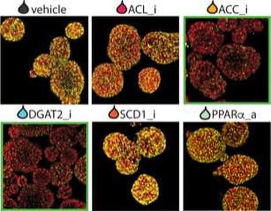 Novel organoid models to study non-alcoholic fatty liver disease