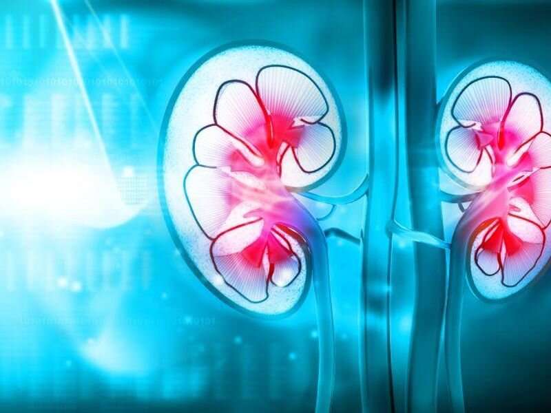 Novel risk tool IDs those at risk for contrast-associated acute kidney injury