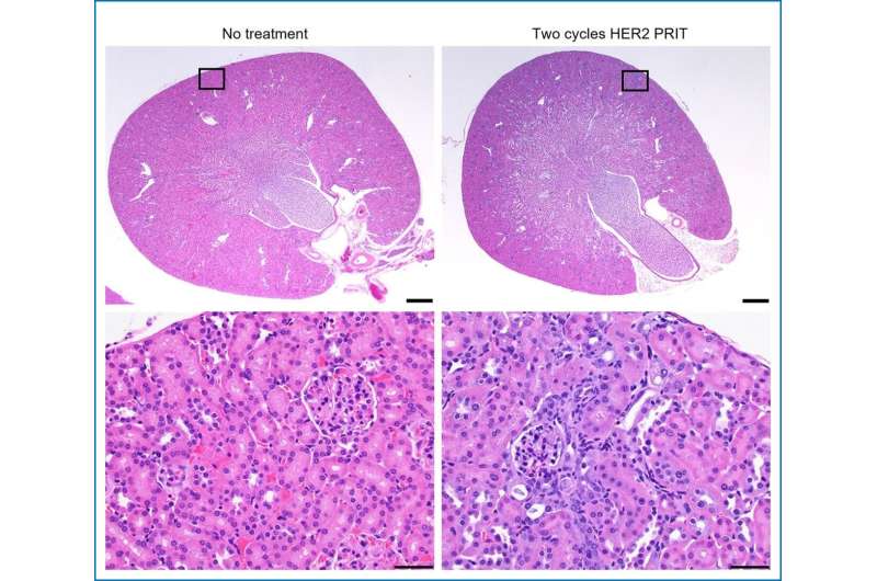 Nuclear medicine treatment cures lethal form of ovarian cancer in preclinical setting