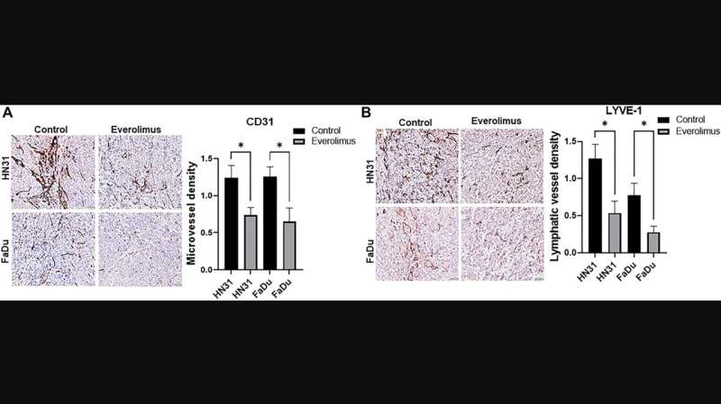 Oncotarget | Everolimus inhibits angiogenesis and lymphangiogenesis in TP53 mutant HNSCC by downregulating STAT3/HIF-1α/VEGF pat