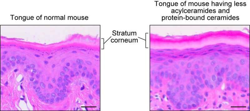 Oral barrier is similar in ceramide composition to skin barrier