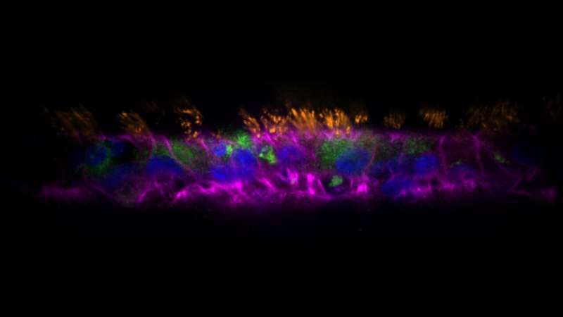 Organoids revolutionize research on respiratory infections