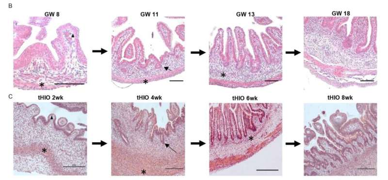 Organoids validated as tool for studying fetal intestine development