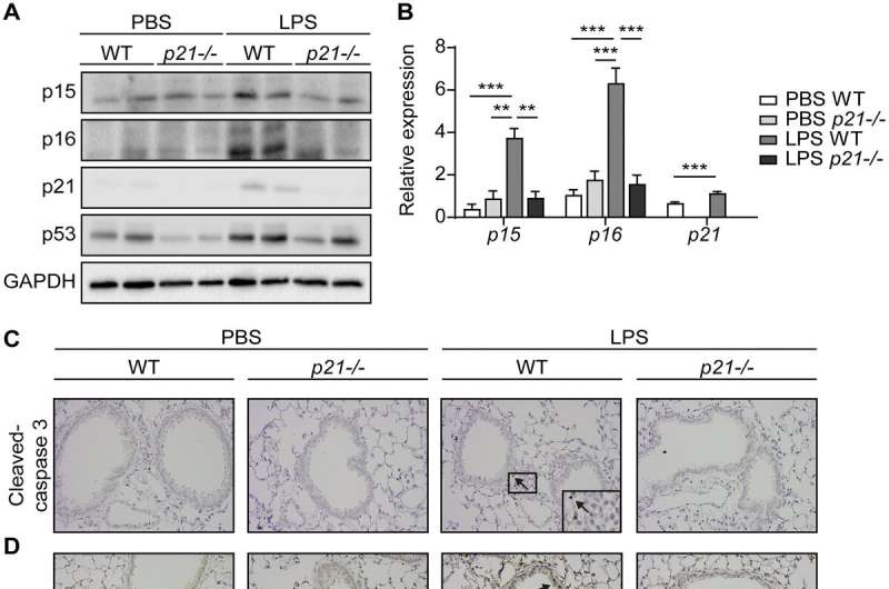 p21 facilitates chronic lung inflammation via epithelial and endothelial cells