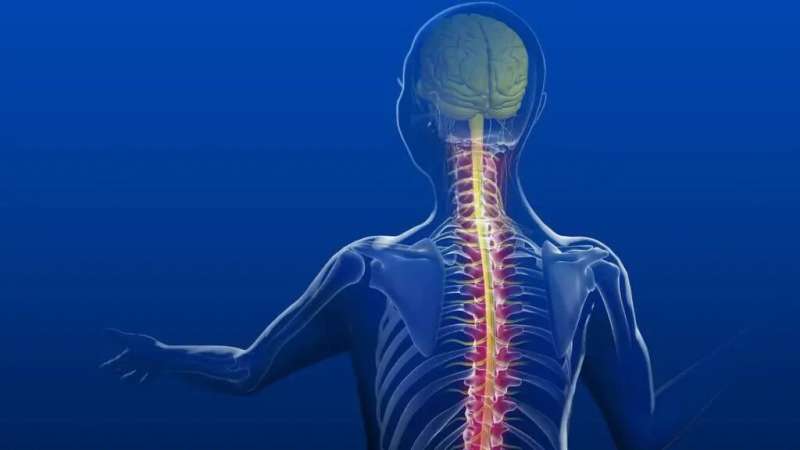 Pain in the back: Preventing and treating spinal arthritis