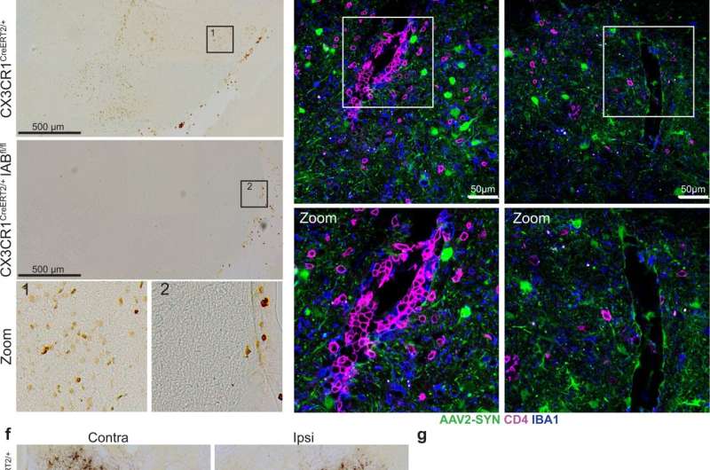 Parkinson's disease: Essential role in neuroinflammation found for a subset of brain macrophages