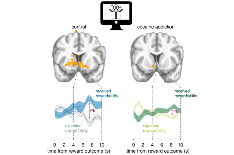 Perception—but not expectation—of reward is altered in people with cocaine addiction