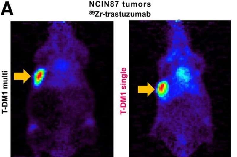 Pet imaging validates use of common cholesterol drug to enhance HER2-targeted cancer therapy