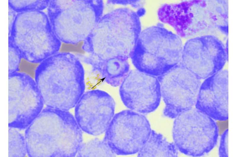 Plasmodium vivax malaria: Infections may be largely underestimated in sub-Saharan Africa