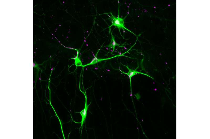 Potential therapeutic target for schizophrenia identified 