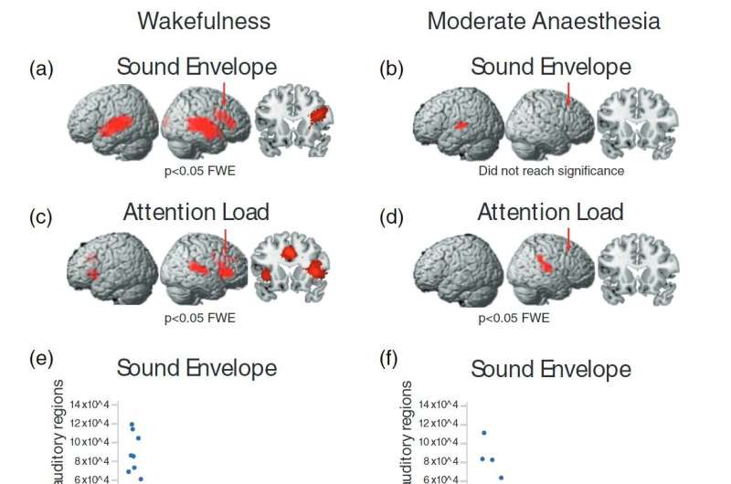 Predisposition to accidental awareness under anaesthesia identified by neuroscientists