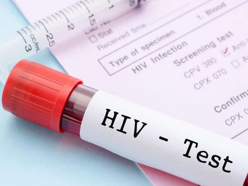 PrEP implant that protects against HIV could be near