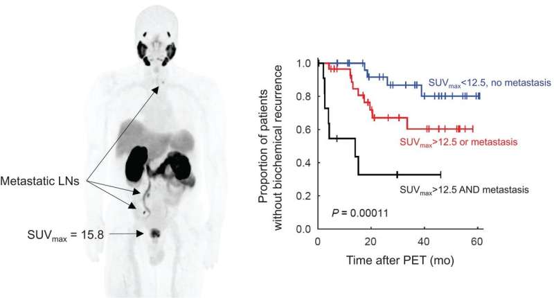 PSMA PET/MRI accurately predicts risk of prostate cancer recurrence