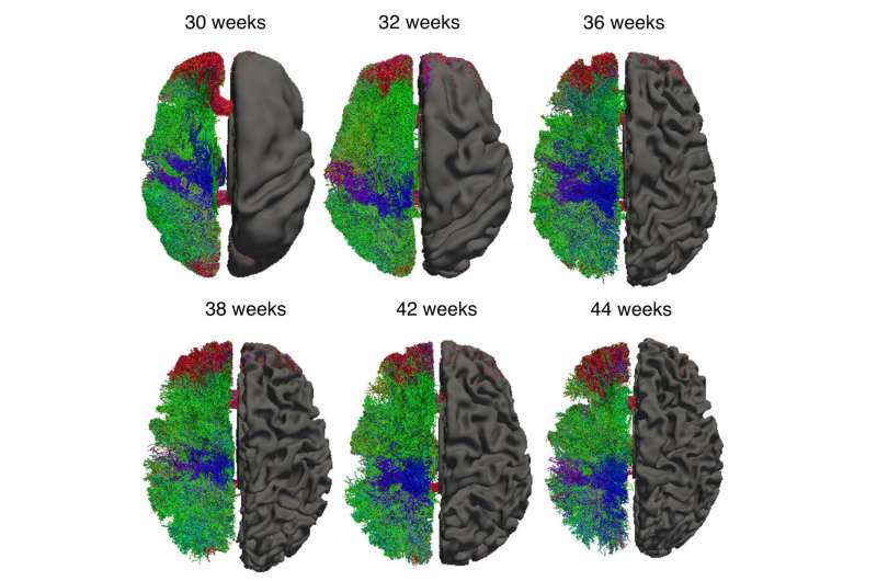 Q&amp;A: How new software is changing our understanding of human brain development