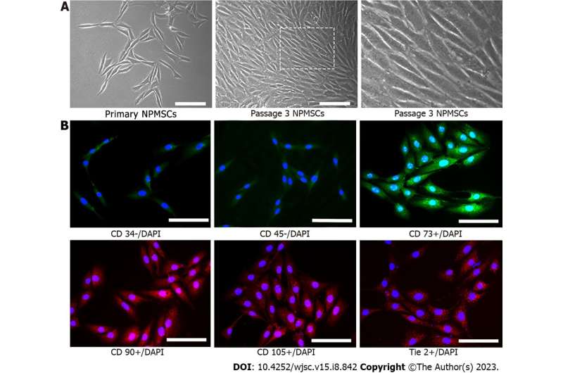 Quercetin ameliorates oxidative stress-induced senescence in rat nucleus pulposus-derived mesenchymal stem cells