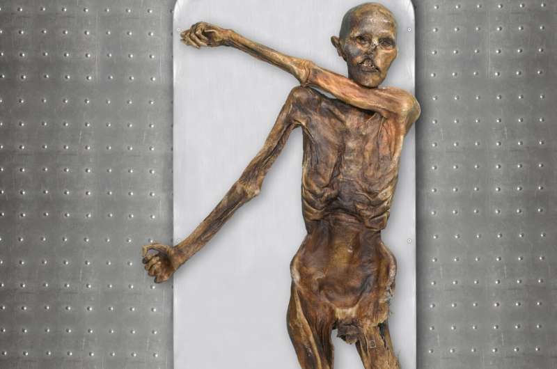 Reanalysis of Iceman Ötzi's genome reveals dark skin, male pattern baldness, and more