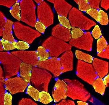 Rode bloedceldeeltjes zijn effectieve medicijndragers bij het onderdrukken van spierverlies veroorzaakt door kanker: NUS-onderzoek