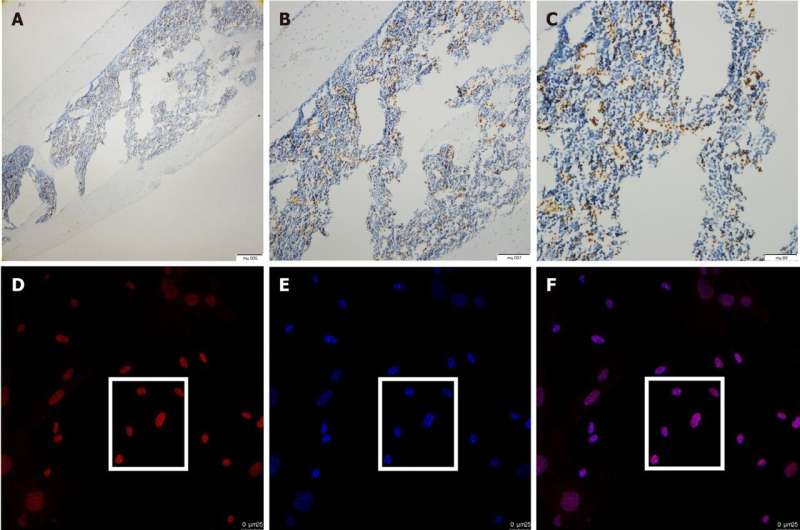 Regenerative potential of mouse bone marrow mesenchymal stromal cells
