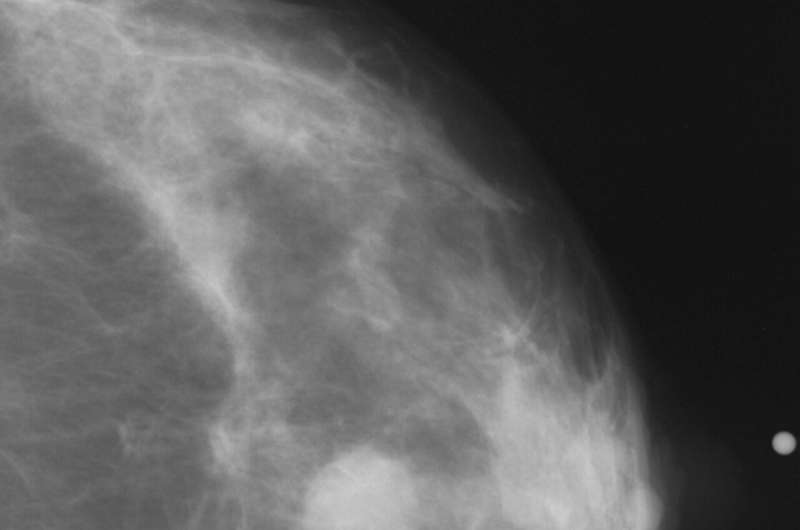 Regular screening mammograms significantly reduce breast cancer deaths