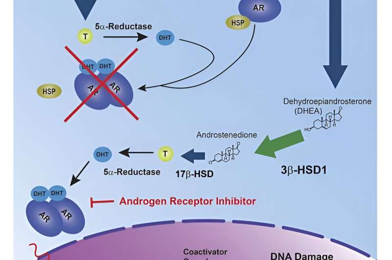 Research finds correlation between biomarker HSD3B1 and resistance to combined hormone therapy and radiotherapy