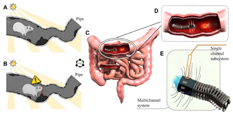 Research team proposes novel AI-enabled gastrointestinal diagnostic system inspired by rat whiskers