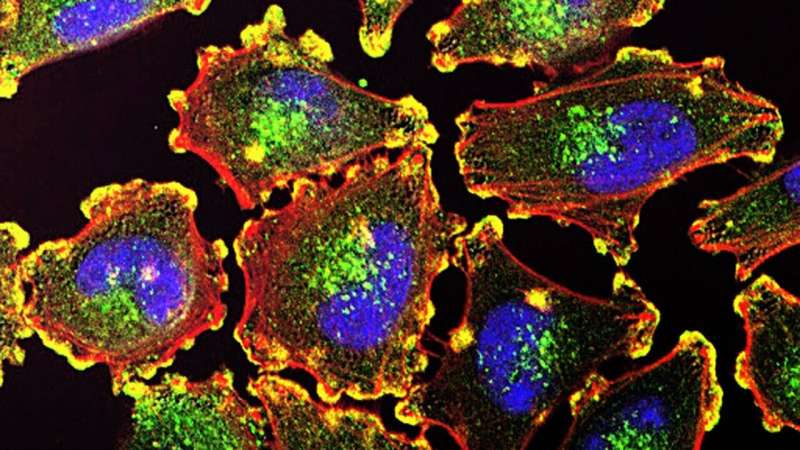 Researchers combine three technologies to fight metastatic cancer with light