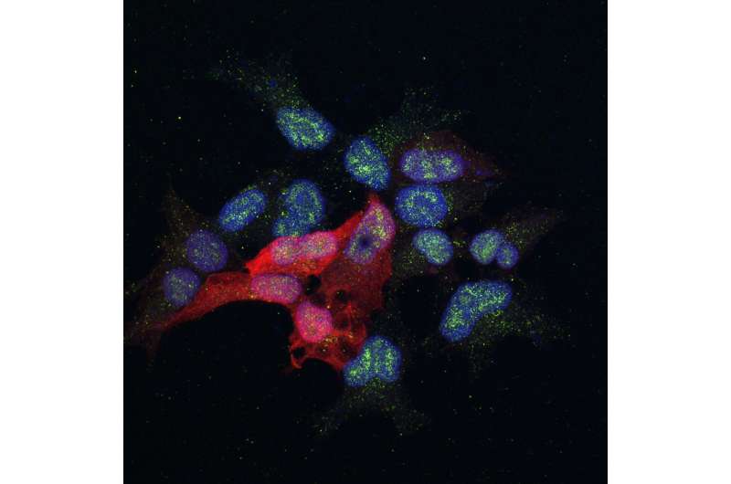 Researchers decipher the mechanism by which the MAF protein promotes breast cancer metastasis
