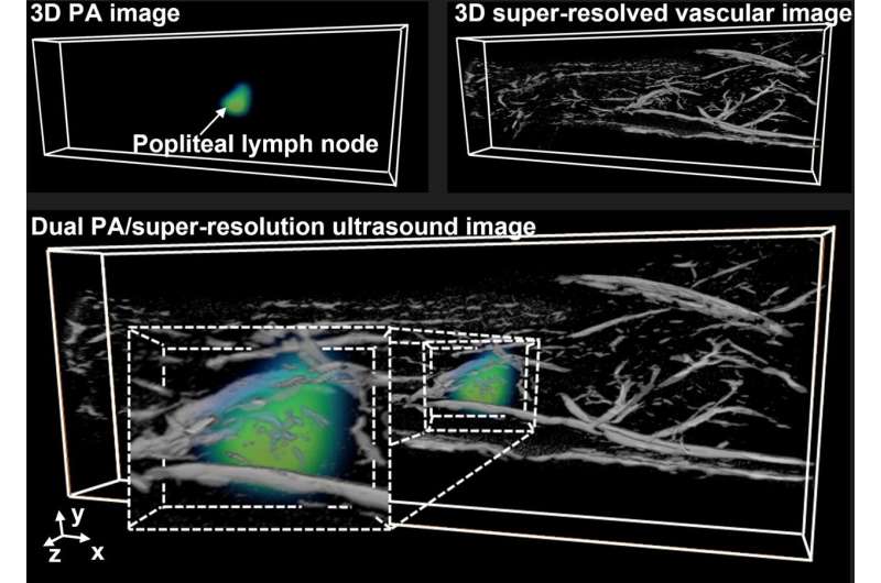 Researchers develop new lower cost, dual-modality imaging technique to facilitate earlier disease detection