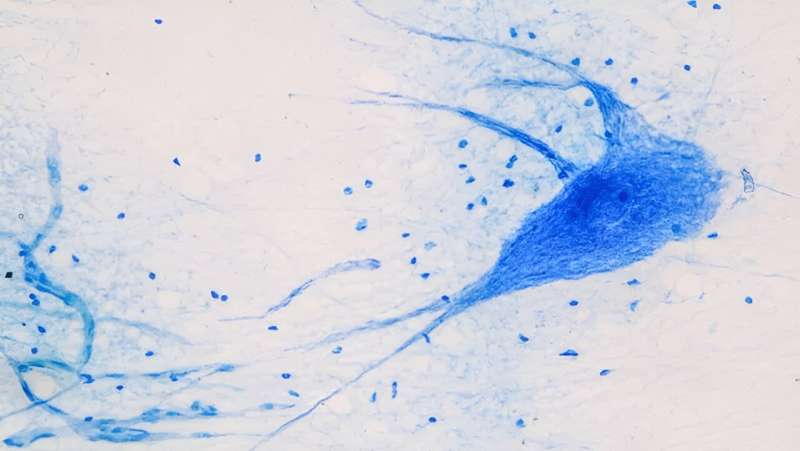 Researchers develop new method to find potential treatment for neuromuscular diseases