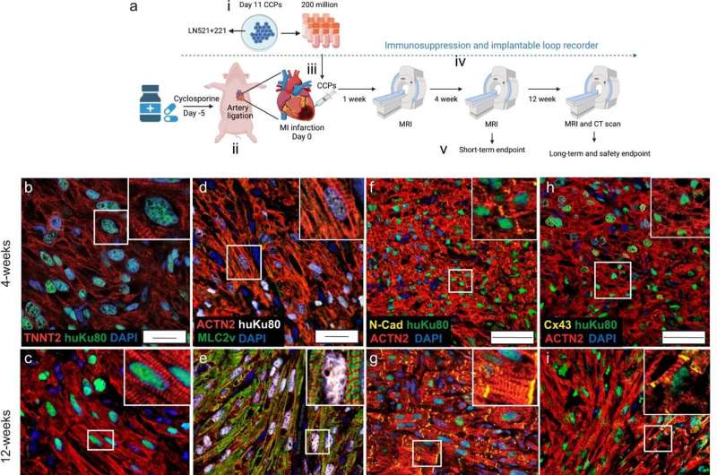 Researchers develop promising stem cell-based regenerative therapy for heart disease