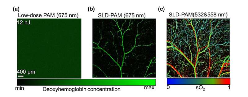 Researchers develop ultra-sensitive photoacoustic microscopy for wide biomedical application potential