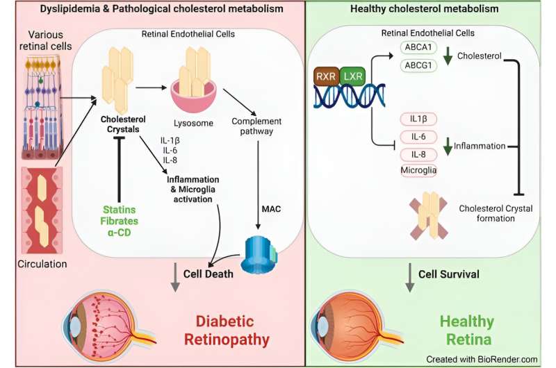 Researchers discover link between cholesterol and diabetic retinopathy
