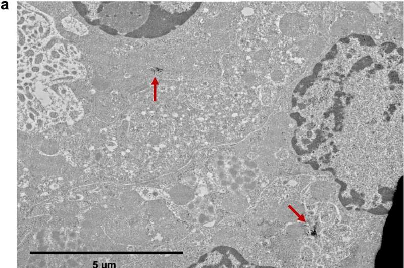 Researchers find nanoparticles of a rare earth metal used in MRI contrast agents can infiltrate kidney tissue