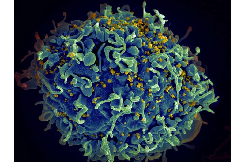 Researchers find new pathway for HIV invasion of cell nucleus