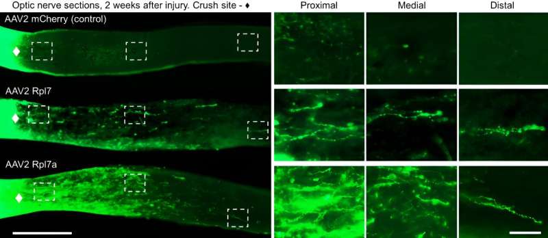 Researchers find that youthful proteins help nerves regrow