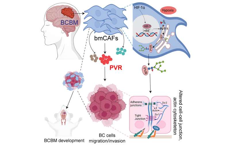 Researchers identify pathway that controls breast cancer metastasis to the brain