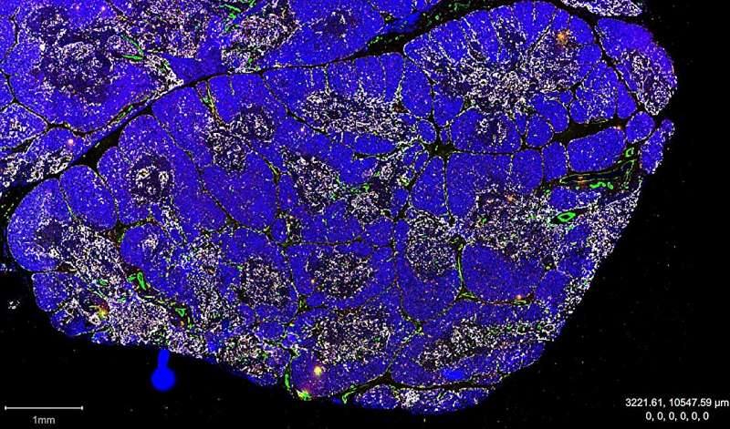 Researchers identify stem cells in the thymus for the first time
