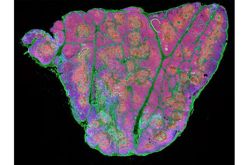 Researchers identify stem cells in the thymus for the first time