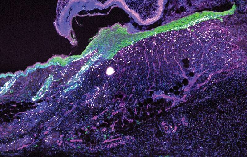Researchers reveal an ancient mechanism for wound repair