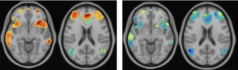 محققان افسردگی را با معکوس کردن سیگنال های مغزی که مسیر اشتباهی را طی می کنند، درمان می کنند