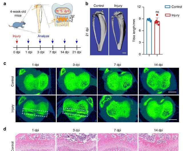 Researchers unveil the role of primary cilia in facilitating cartilage regeneration after growth plate fractures