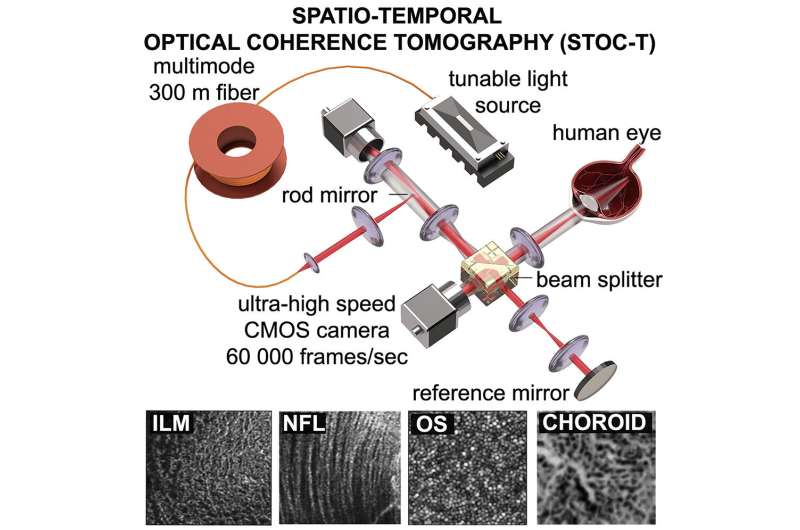 Retina and choroid without secrets: STOC tomography enables unprecedented views of eye structure