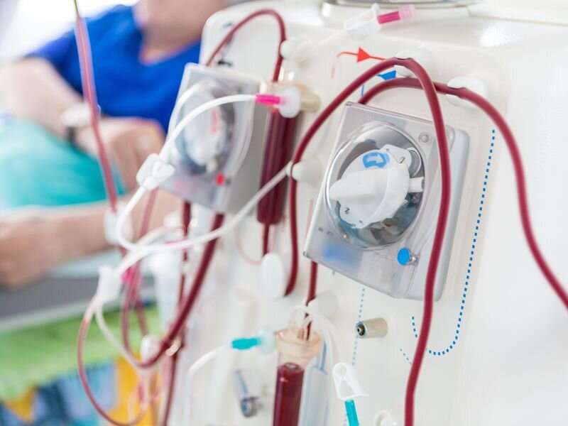Risk for GI bleed increased with hemodialysis versus peritoneal dialysis