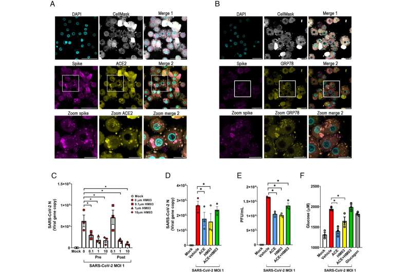 SARS-CoV-2 infects liver, stimulating glucose production and contributing to severe form of COVID-19