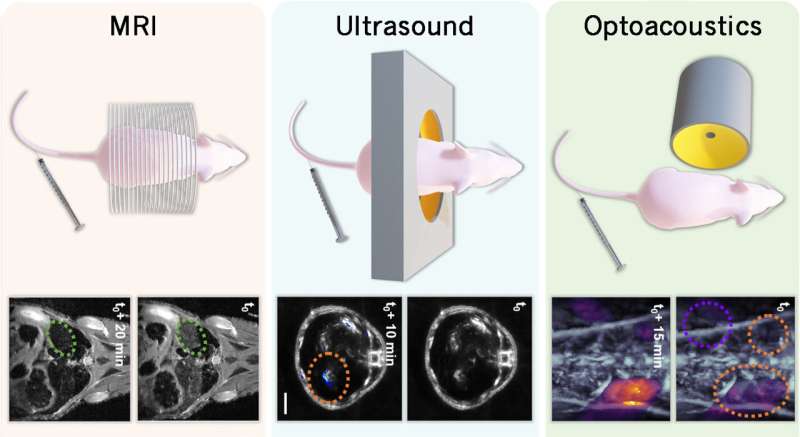 Scientists marry MRI, ultrasound, and optoacoustics for better medical exams