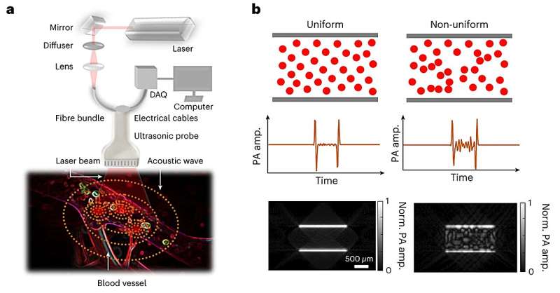 Seeing deep blood flow with sound and laser light