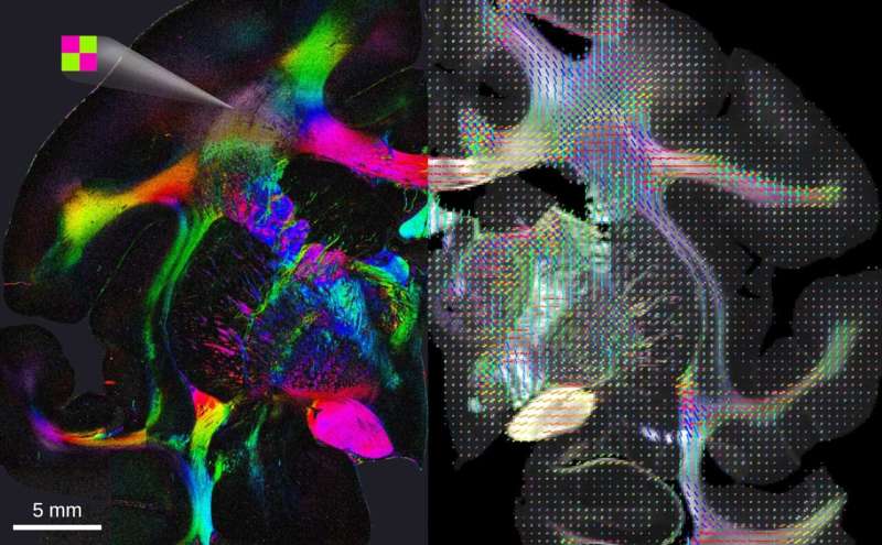 Shining light on densely interwoven nerve fibres inside the brain
