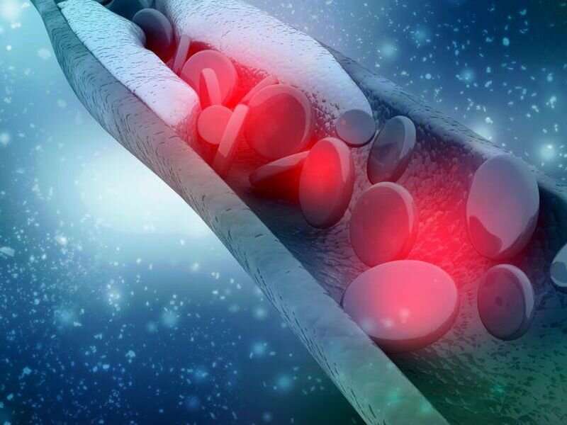 Similar processes could link MS with heart disease