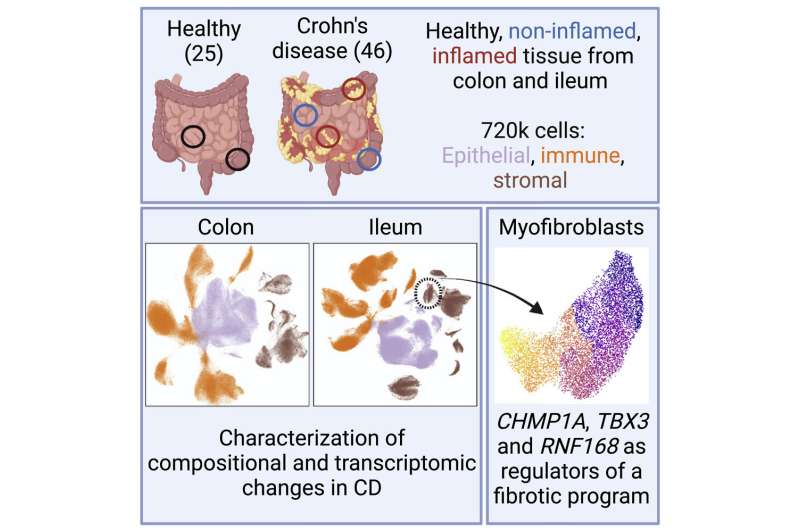 Single-cell analysis of Crohn's disease reveals a detailed picture of inflammation in the gut